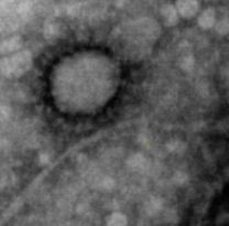 Por primera vez lograron fotografiar el coronavirus que circula en Argentina