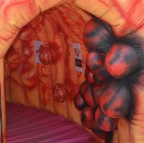 Campaña de prevención del cáncer de colon en el hospital Señor del Milagro