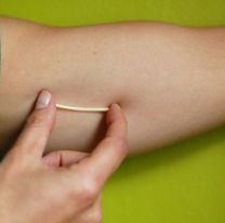 Se colocarán “chips anticonceptivos” en el centro de salud del Bº Autódromo