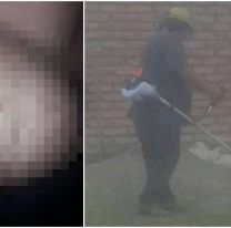 “Necesito que me operen para llevar el pan a mi casa”, el pedido de un salteño