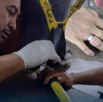 15 horas de desesperación: Bomberos sacaron el anillo atorado del dedo de una joven